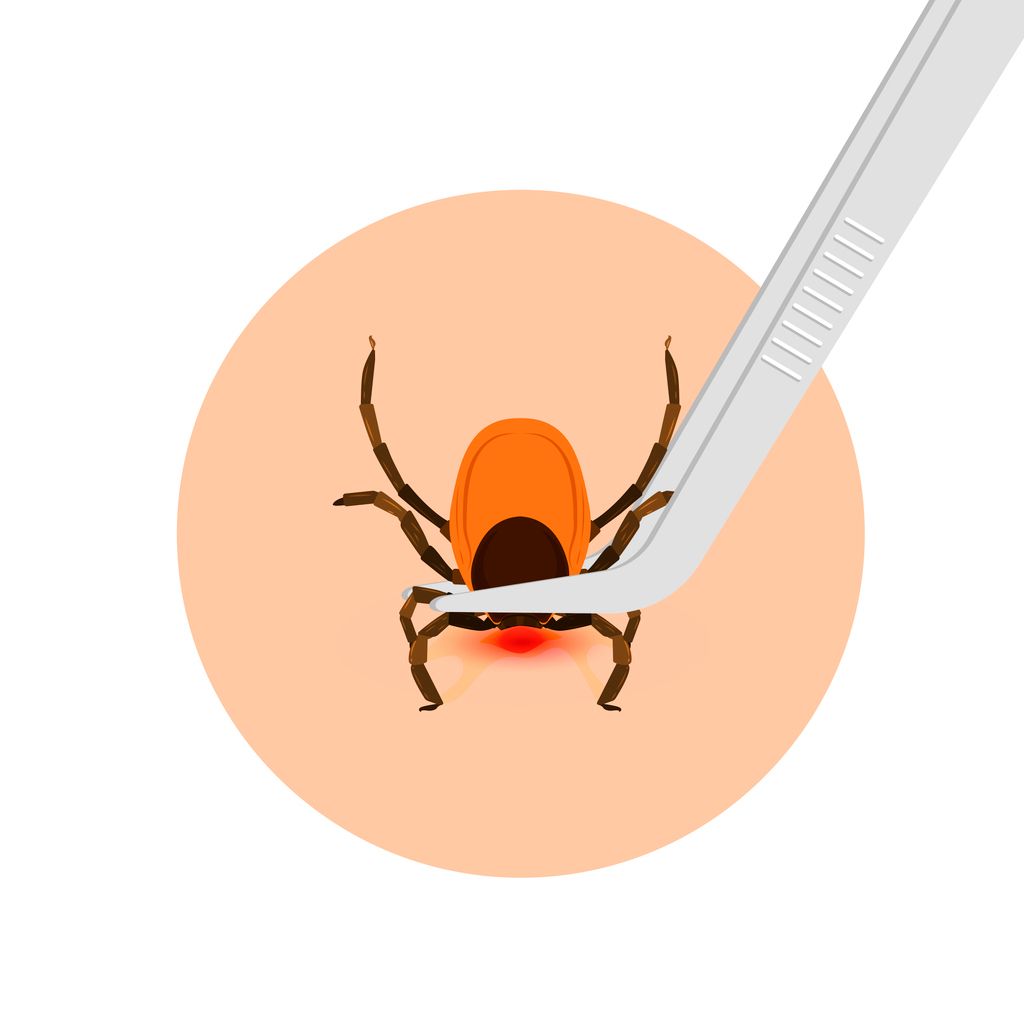 A graphic showing a pair of tweezers holding a tick
